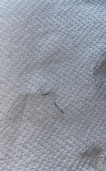 Ridiculously worried, found metal in takeaway