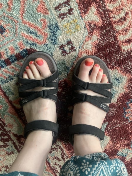 I’m going mad! Sandals for painful bunion feet - which are best.