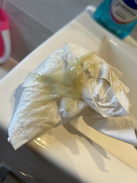 Could it be mucus plug? TMI PICTURE INCLUDED