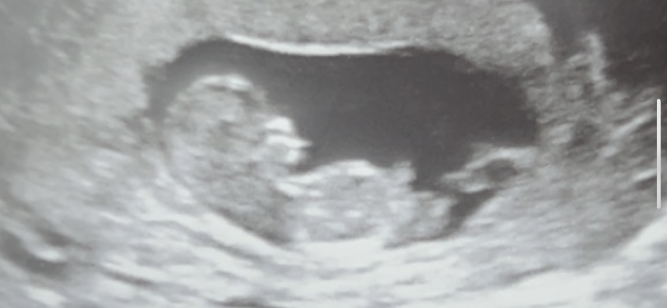 Boy or girl nub theory?? Xxxxx
