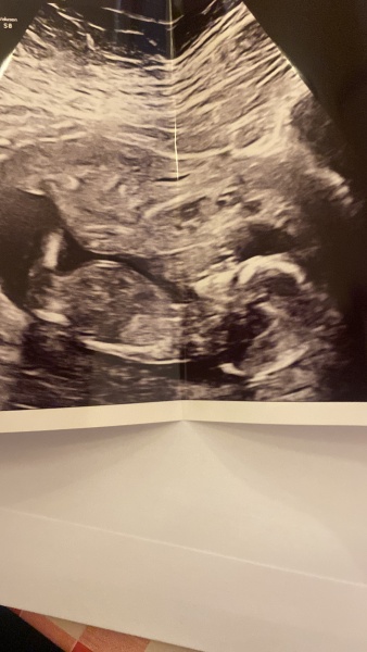 Please could anyone look at my scan for nub theory :)