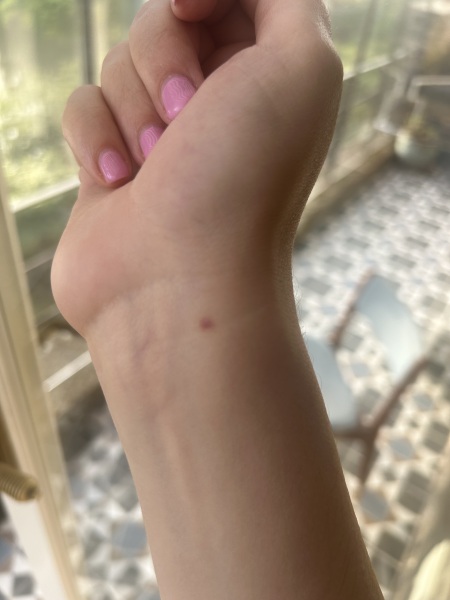 Purple spot out of nothing