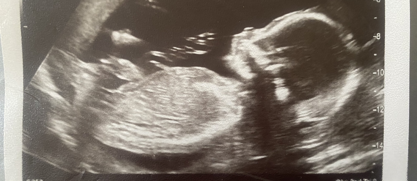 Girl or boy