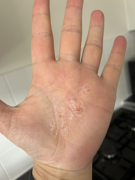 Skin causing me to cry. How can I help it?