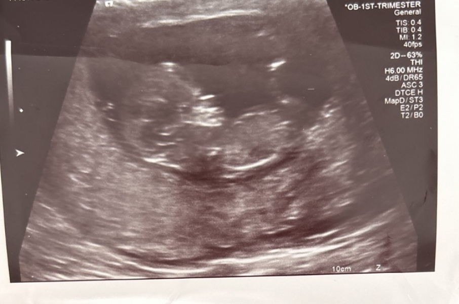 Scan picture