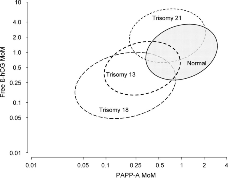 T21 risk much greater than T13/18