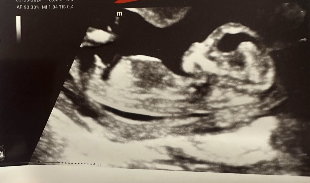 Boy or a girl?! Skull / Nub Theory 😊