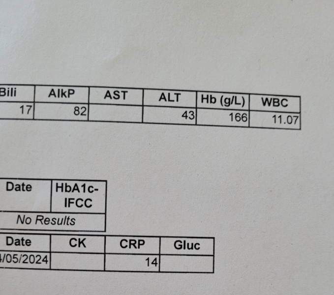 Interpretation of test results