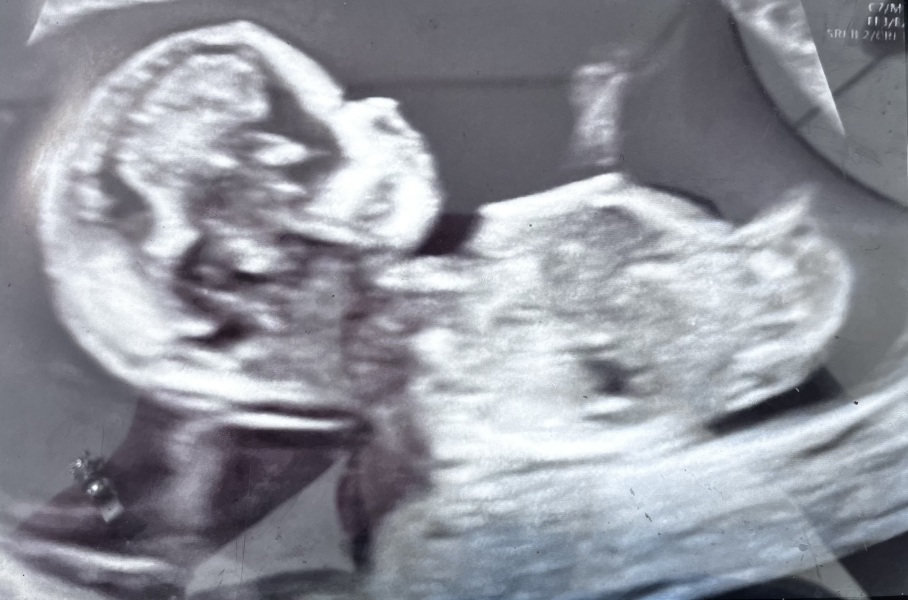Gender Guesses....