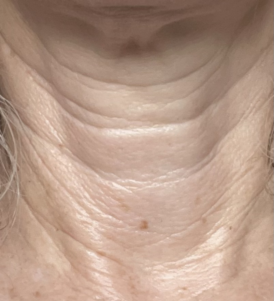How old is my neck??