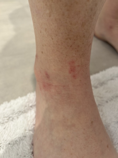 Does this look like an allergy?