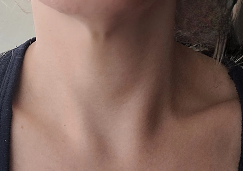 How old is my neck??