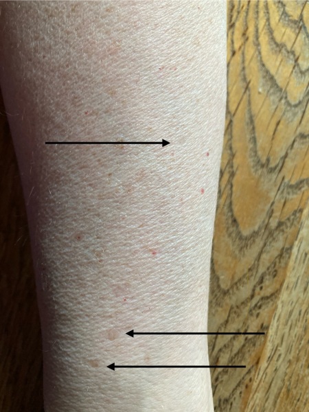 Is this something to show the doctor, or just normal aging?