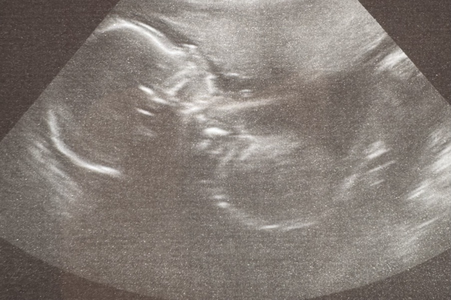 September 2024 - Thread 7! 🐣🧡💛❤️