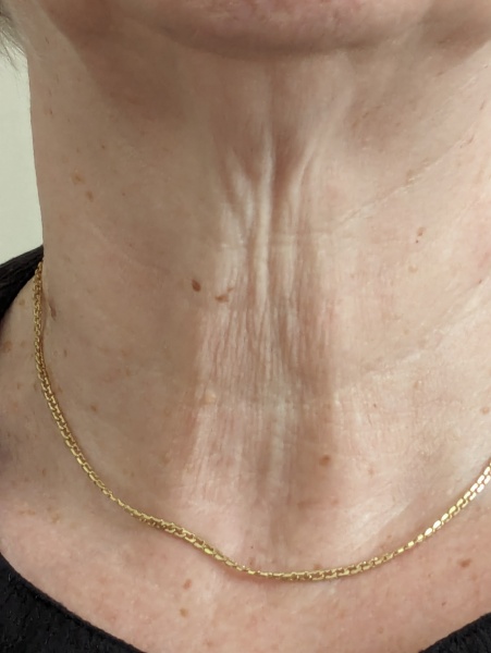 How old is my neck??