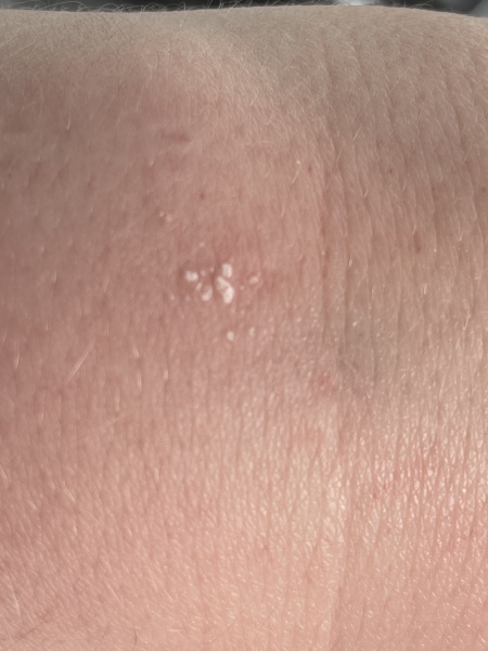 What on Earth is this on my skin?