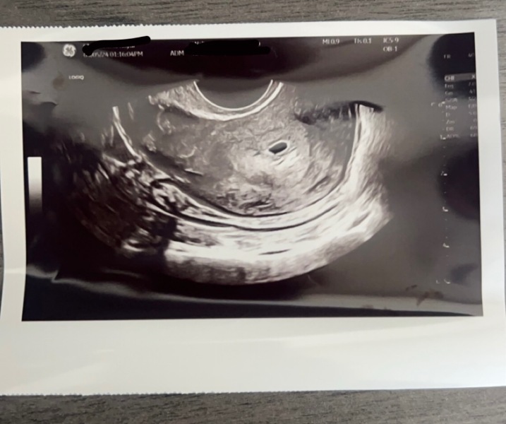 Anyone want to join for two week wait?