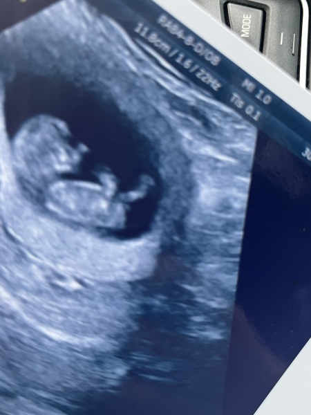 Gender guesses please ?