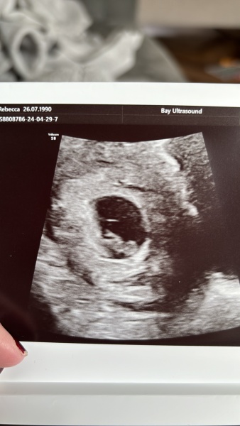 Dec-Christmas Babys 2024