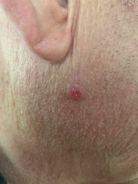 What could this be on my father's face?