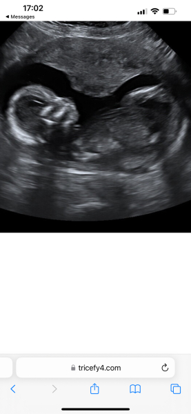 Anyone want me to take a look at their nubs?