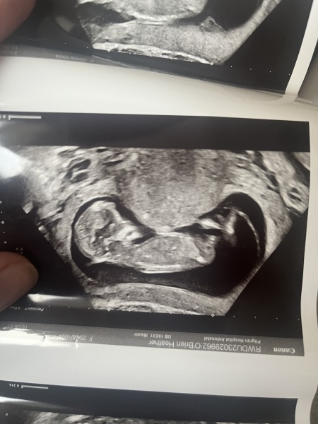 Can anyone guess the gender 💙💕