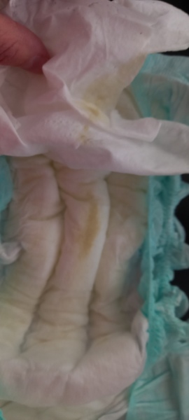 Any ideas what this is? (Nappy pics)