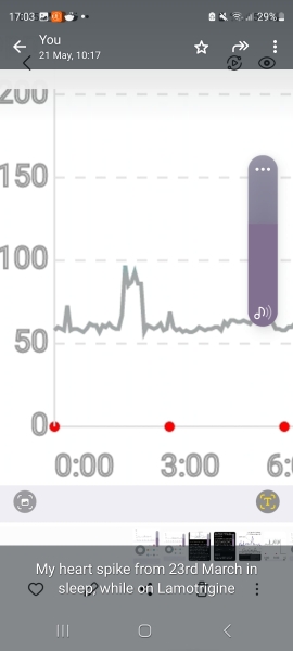 Can you read my heart rate? Any experts appreciated.