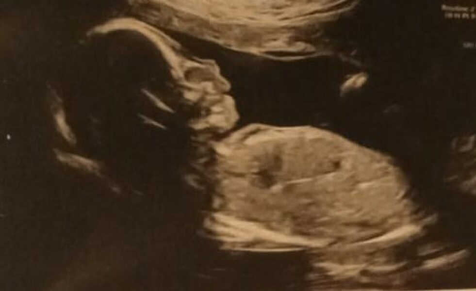 Did you just 'know' the baby's sex?