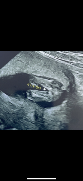 Is this definitely a baby girl?!