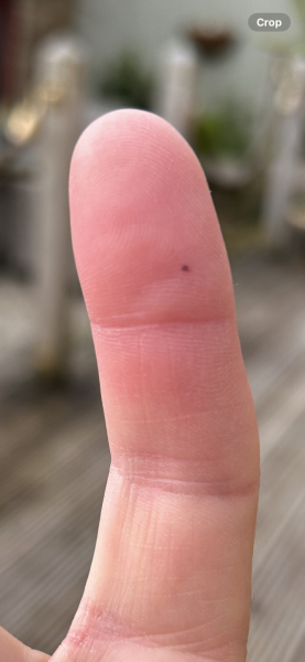I’ve been stung by a hornet and it is sheer agony