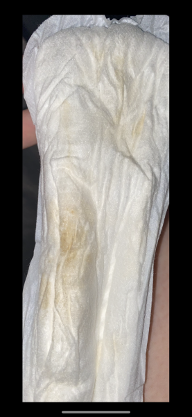 38 weeks preg, what’s this in pad?