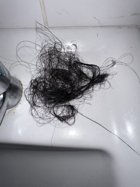 Hair loss