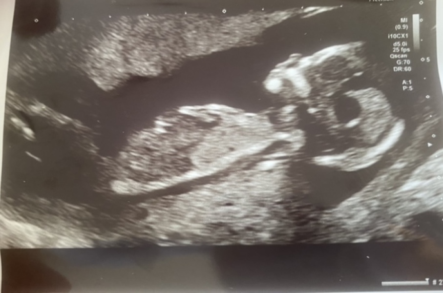 Help me guess the gender!
