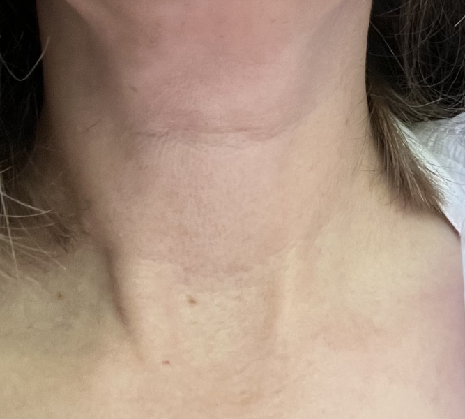 How old is my neck??