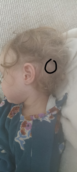 Lump on head