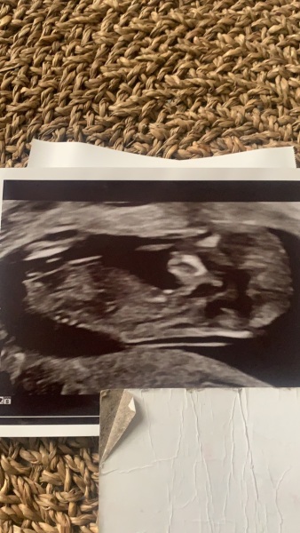 Gender guesses?
