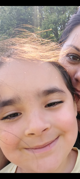 Toddler with chalazion on eye (picture)