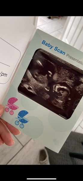 Any gender guesses?