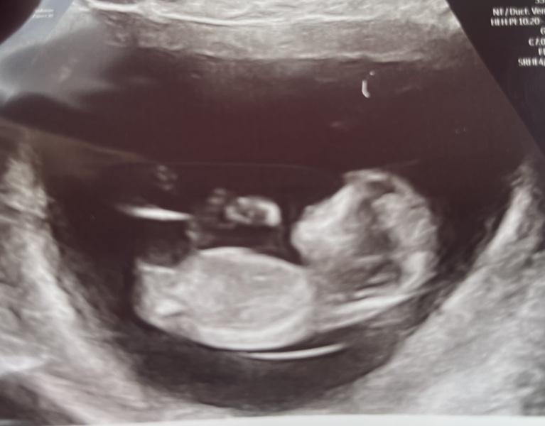 November Babies: Thread 4 (Into the Second Trimester and Beyond!)