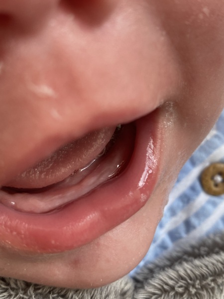 Does this look like teething?