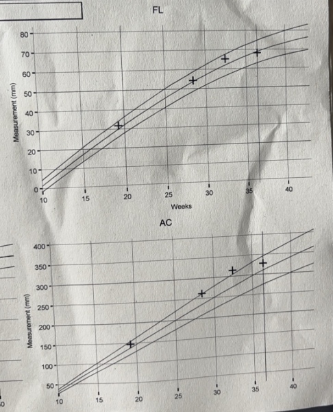 Up and down baby measurements from 98th to 48th percentile