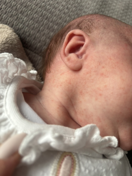 Colic ? Reflux ? HELP!