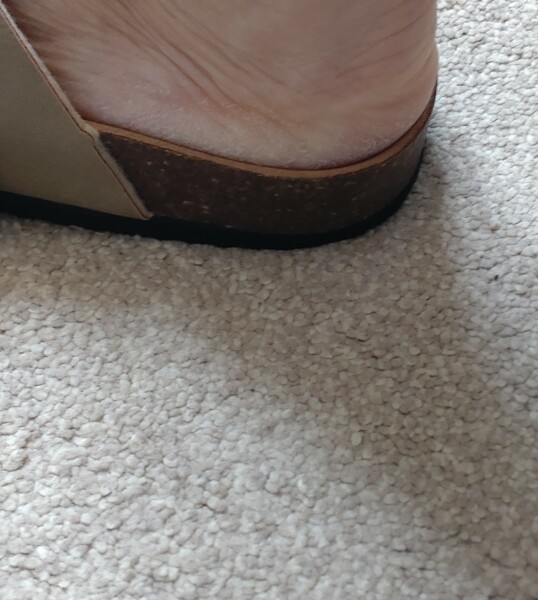 Should I size up? Pic attached