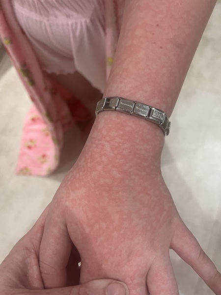 To take DD to the doctor for this rash