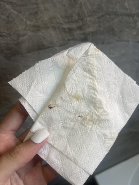 Blood when I wiped, 36 weeks