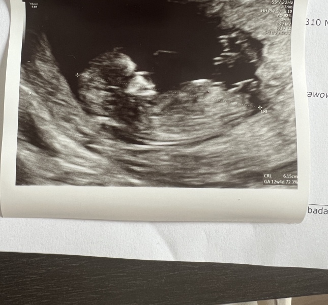 Boy or girl nub theory?? Xxxxx