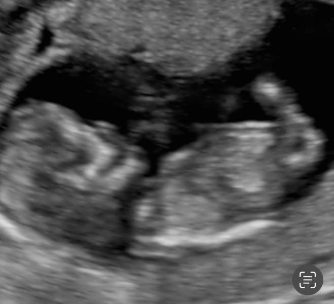 Gender guesses?!