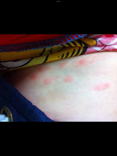 Does this look like shingles?
