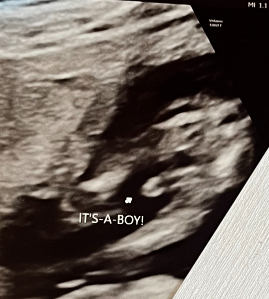 Told boy and girl but confused at image